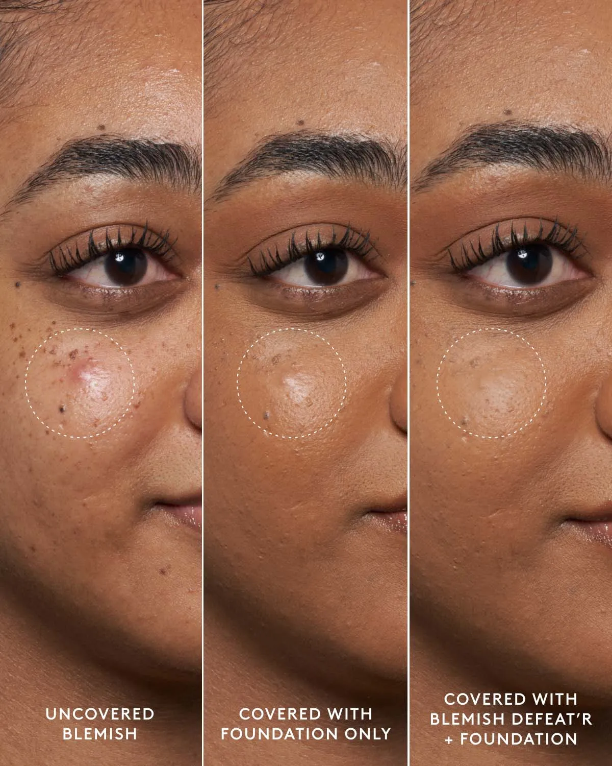 Blemish Defeat'r BHA Spot-Targeting Gel Fenty Beauty