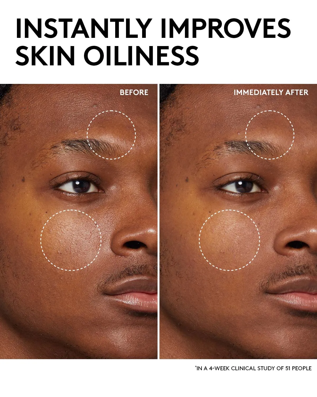 Fenty Skin Start’rs Full-Size Bundle: Oily Skin Edition Fenty Beauty