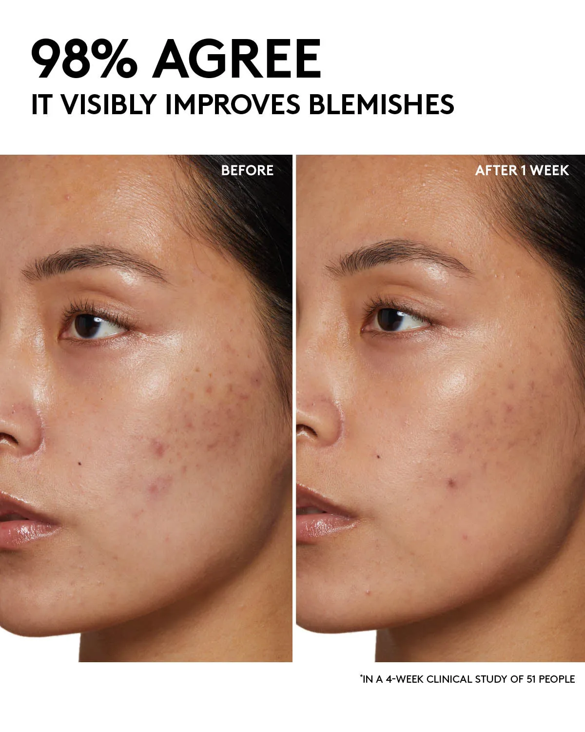 Fenty Skin Start’rs Full-Size Bundle: Oily Skin Edition Fenty Beauty