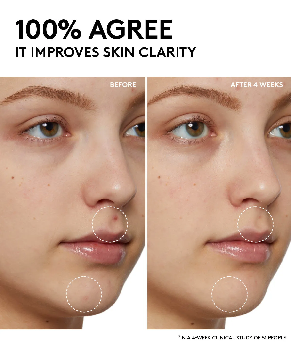 Fenty Skin Start’rs Full-Size Bundle: Oily Skin Edition Fenty Beauty