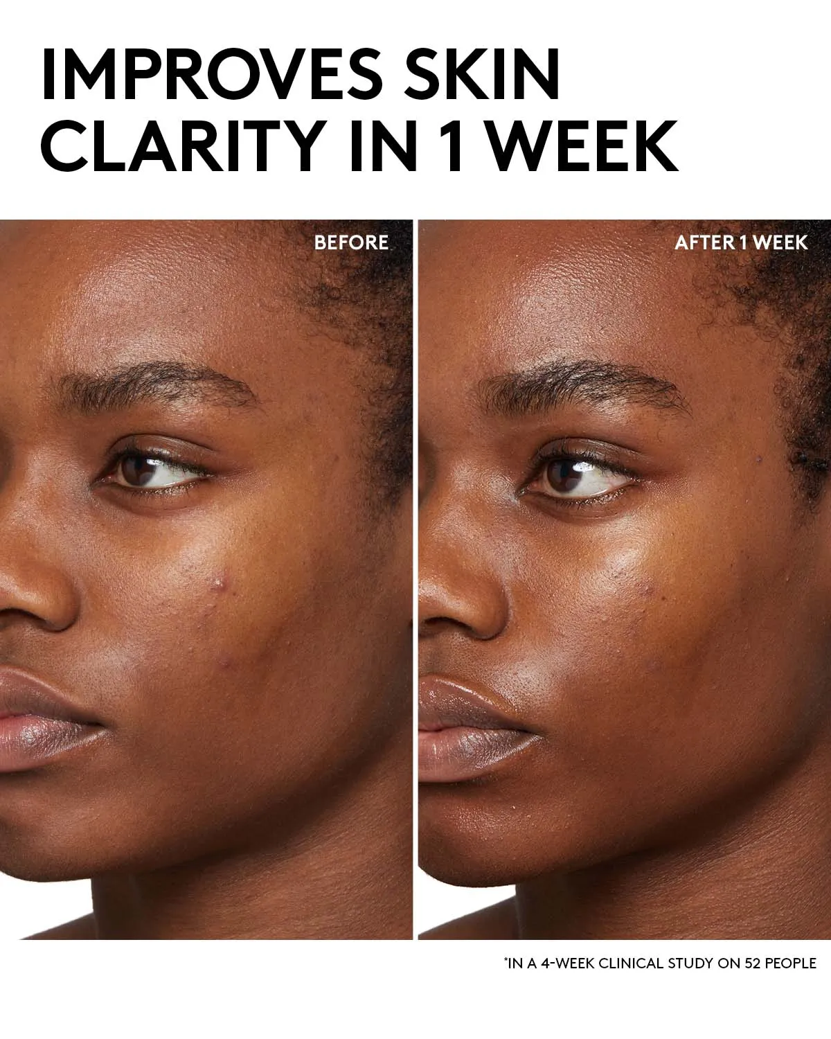 Fenty Skin Start’rs Full-Size Bundle: Oily Skin Edition Fenty Beauty