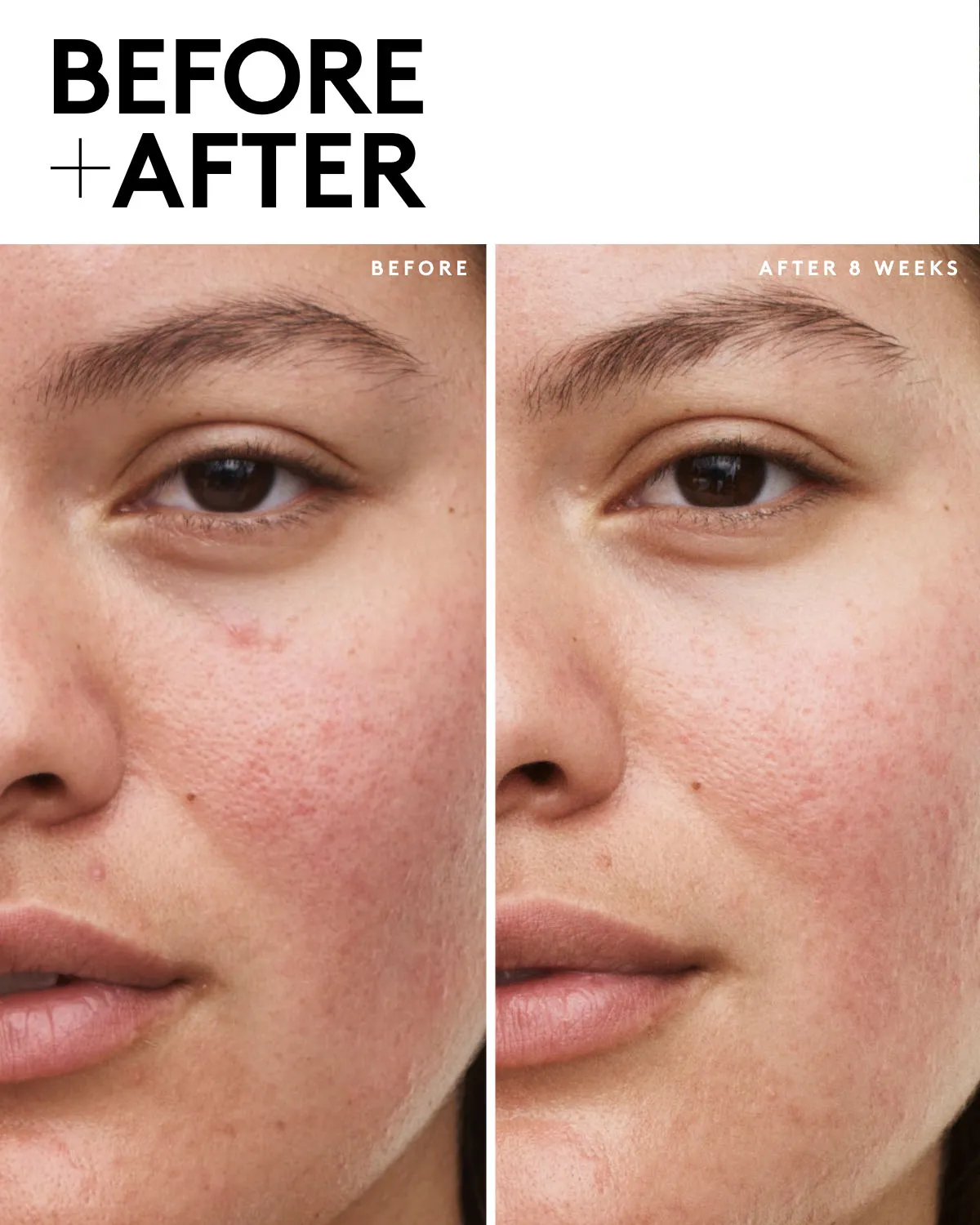Fenty Skin Travel-Size Start'r Set with Mineral SPF: Dry Skin Edition Fenty Beauty