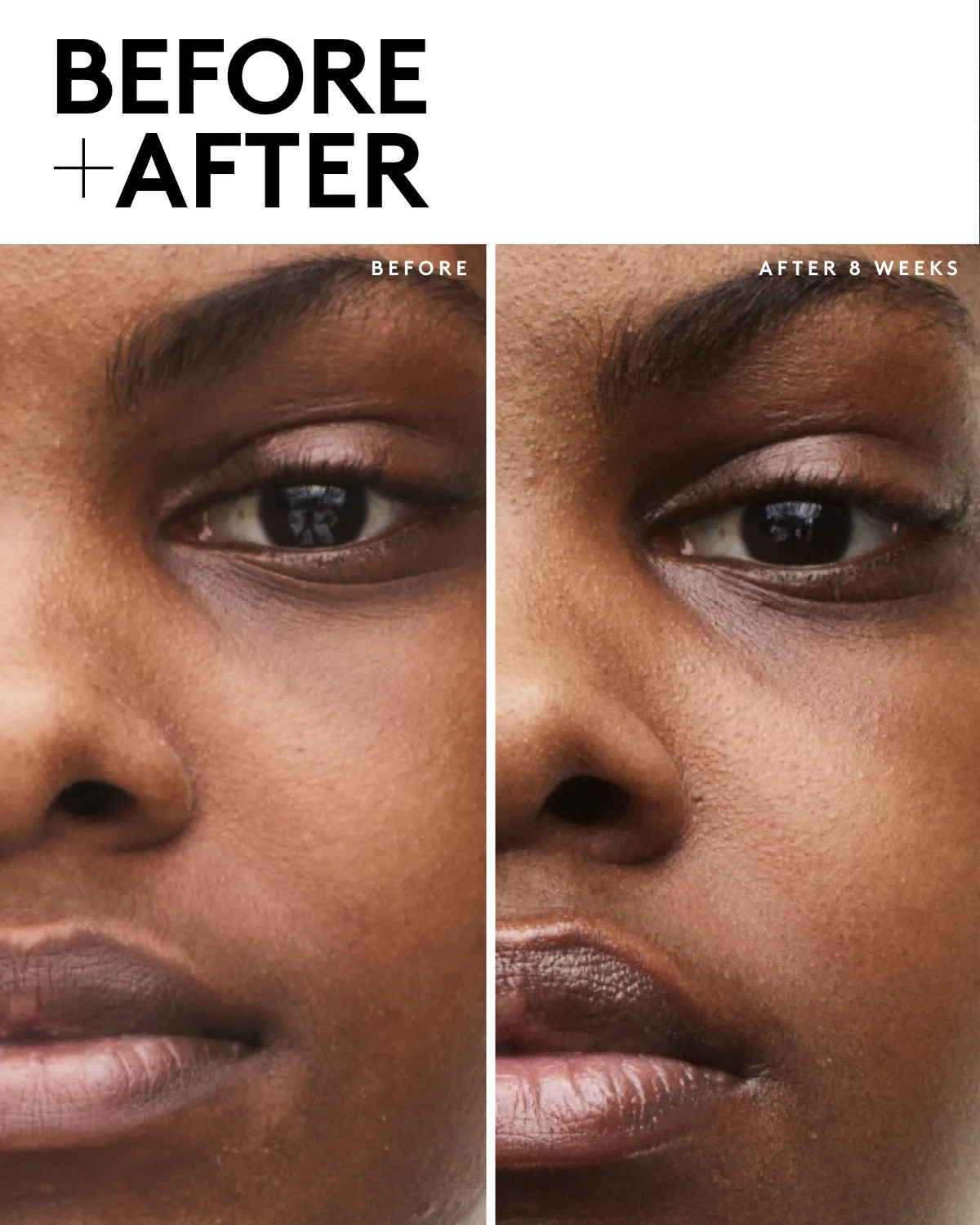 Fenty Skin Travel-Size Start'r Set with Mineral SPF: Dry Skin Edition Fenty Beauty