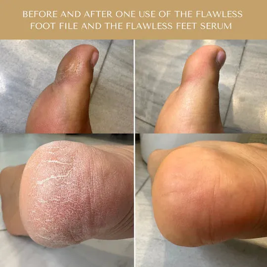 Serum Doctor Flawless Feet Serum